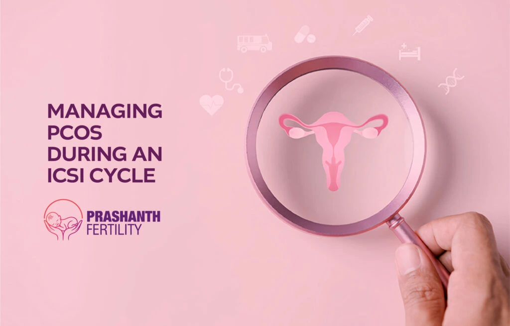 Managing PCOS During an ICSI Cycle
